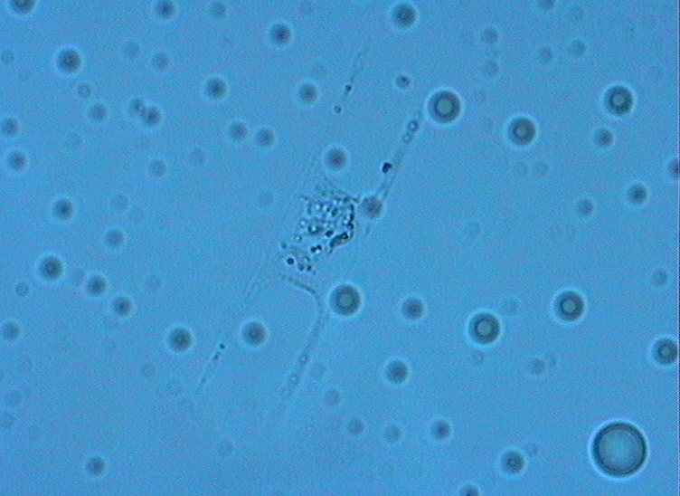 Dictyocha speculum